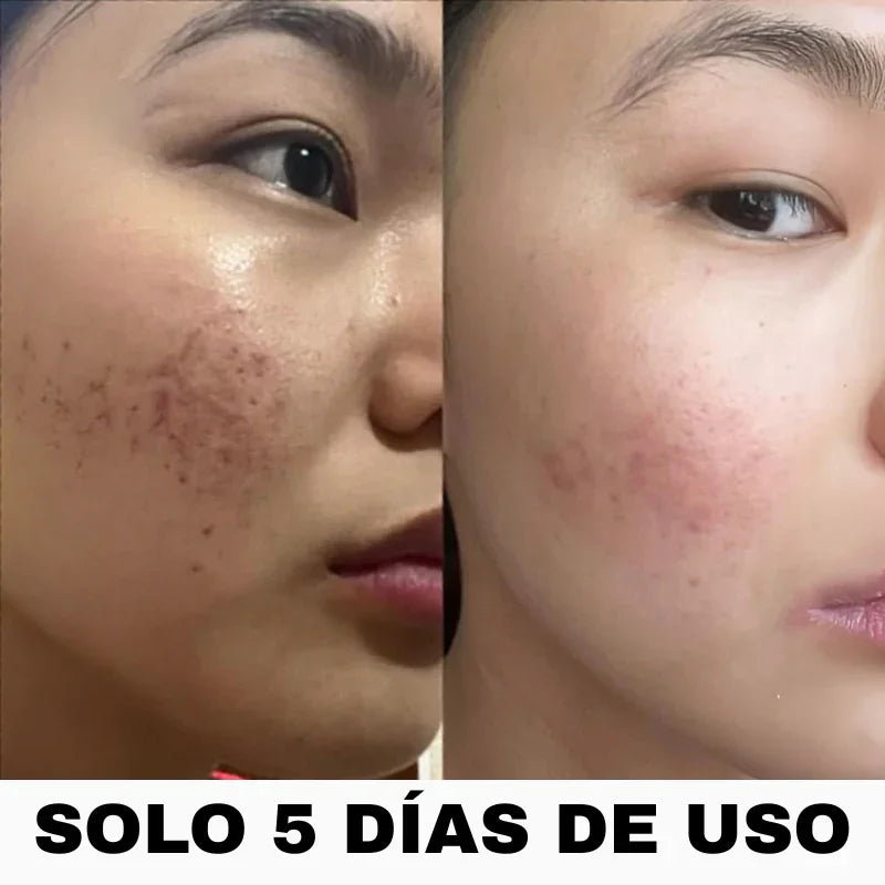 ANUA Heartleaf - Secreto para una piel perfecta + Guía Exclusiva de Regalo