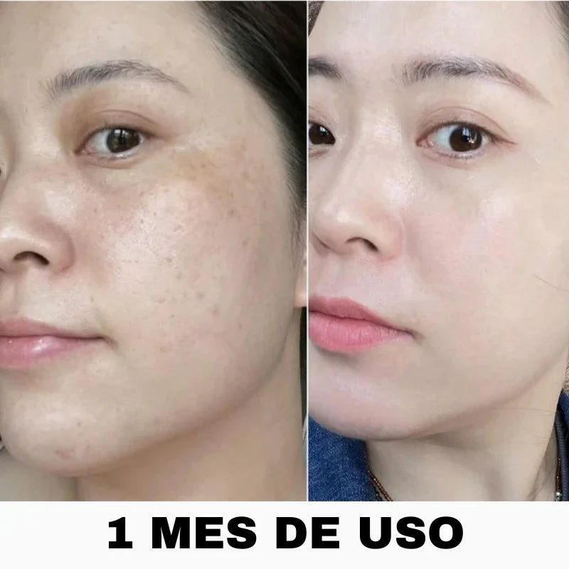 ANUA Heartleaf - Secreto para una piel perfecta + Guía Exclusiva de Regalo